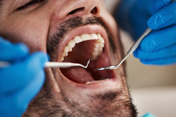 Emergency Dental Services in Westphalia, MD